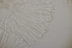 Leptotrochila verrucosa