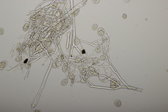 Peronospora arvensis