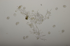 Peronospora arvensis