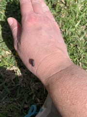 Armadillidium vulgare