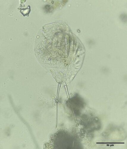 Cephalodella tenuiseta