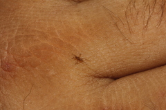 Hippoboscoidea