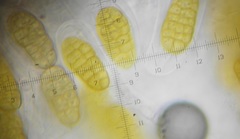 Stemphylium vesicarium