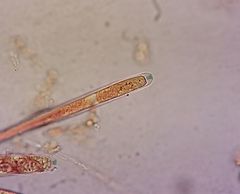 Bryoscyphus rhytidiadelphi