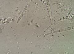 Bryoscyphus rhytidiadelphi