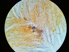 Arachnopeziza trabinelloides