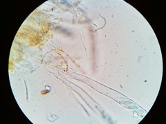 Arachnopeziza trabinelloides