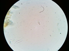 Arachnopeziza trabinelloides