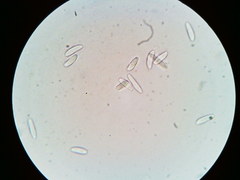 Arachnopeziza trabinelloides