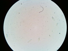 Arachnopeziza trabinelloides