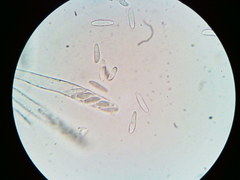 Arachnopeziza trabinelloides