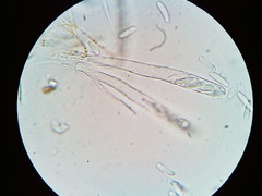 Arachnopeziza trabinelloides