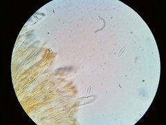 Arachnopeziza trabinelloides