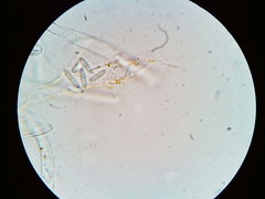 Arachnopeziza trabinelloides