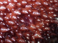 Chondracanthus
