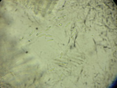 Pyrenopeziza benesuada