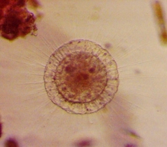 Actinosphaerium