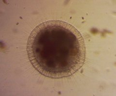 Actinosphaerium
