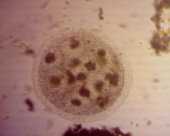 Actinosphaerium