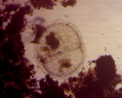 Actinosphaerium
