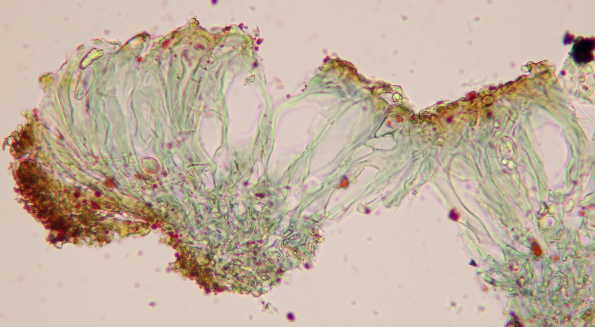 Placynthiella oligotropha image