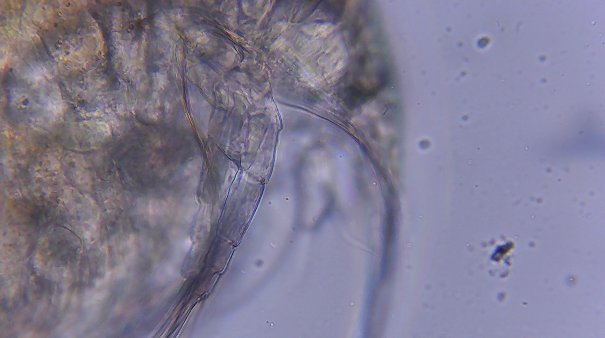 Picripleuroxus denticulatus (Birge, 1879)