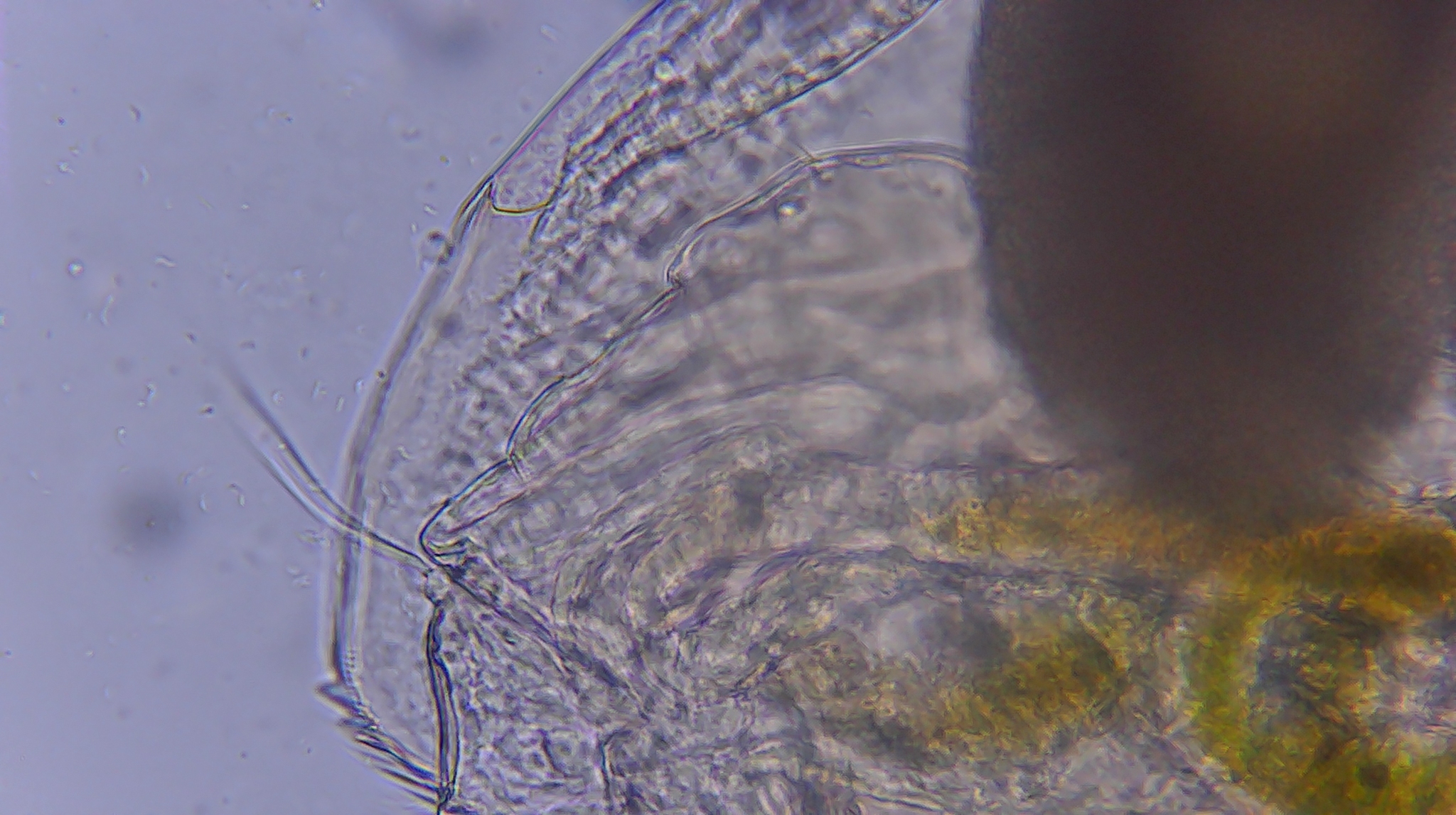 Picripleuroxus denticulatus (Birge, 1879)