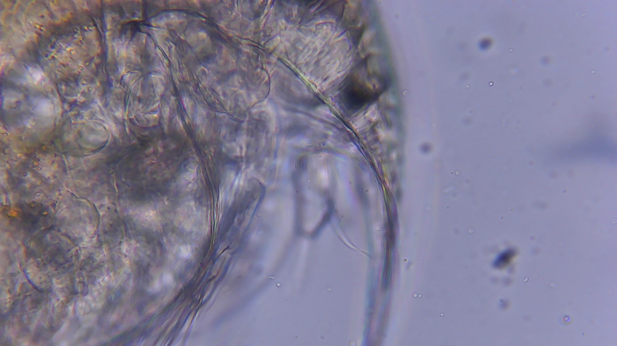 Picripleuroxus denticulatus (Birge, 1879)