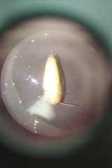 Atelura