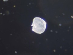 Protoperidinium