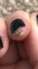 Tropidosteptes quercicola