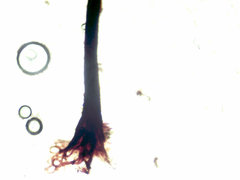 Stemonitopsis hyperopta