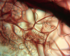 Stemonitopsis hyperopta