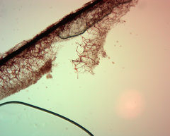 Stemonitopsis hyperopta