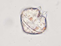 Protoperidinium