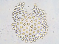Phaeocystis