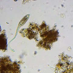 Lacrymaria olor