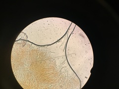 Arachnopeziza trabinelloides