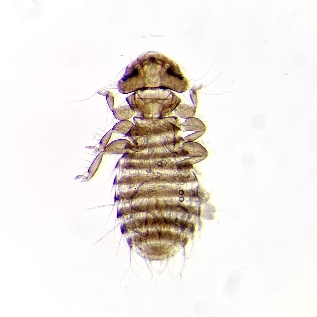 Austromenopon transversum