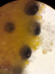 Sphaerellopsis filum