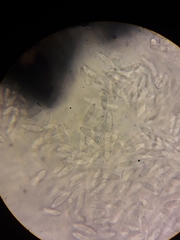 Sphaerellopsis filum