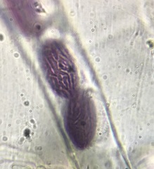 Ascobolus albidus