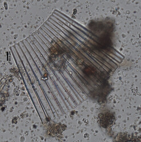 Synedra pulchella, 2026-04-24