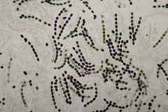 Biscogniauxia nummularia