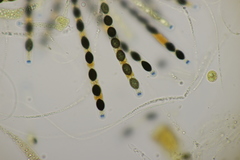 Biscogniauxia nummularia