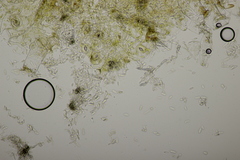 Ramularia variabilis