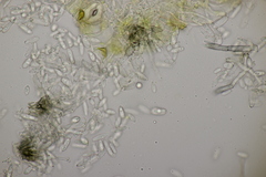 Ramularia variabilis