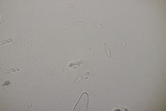 Ramularia variabilis