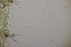 Ramularia variabilis