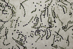 Biscogniauxia nummularia